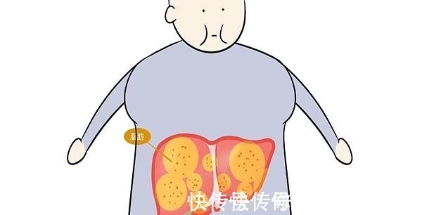 充血性|肝脏开始硬化时，身体会有哪些表现若都没有，放心你没得肝硬化