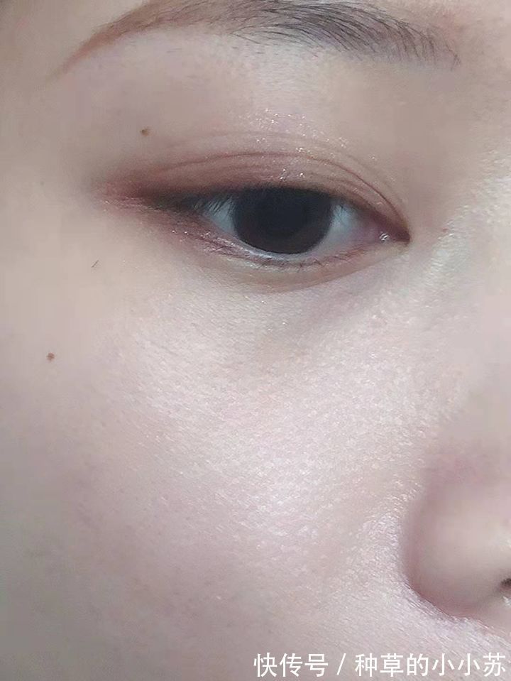 油痘肌|皮肤科主任建议：别被这些“假氨基酸”洗面奶骗了，小心真的烂脸