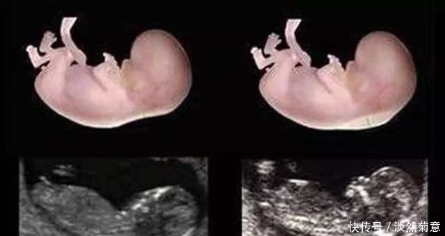 怀孕12周|孕期280天产检要点:时间、项目、注意事项,收藏这篇就够用了