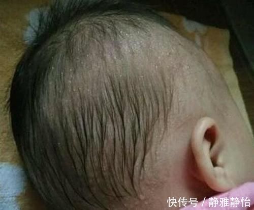 生物蛋白锌|6岁女孩积食不长个，“伤脾王”被揪出，大夫：这东西不能每天吃