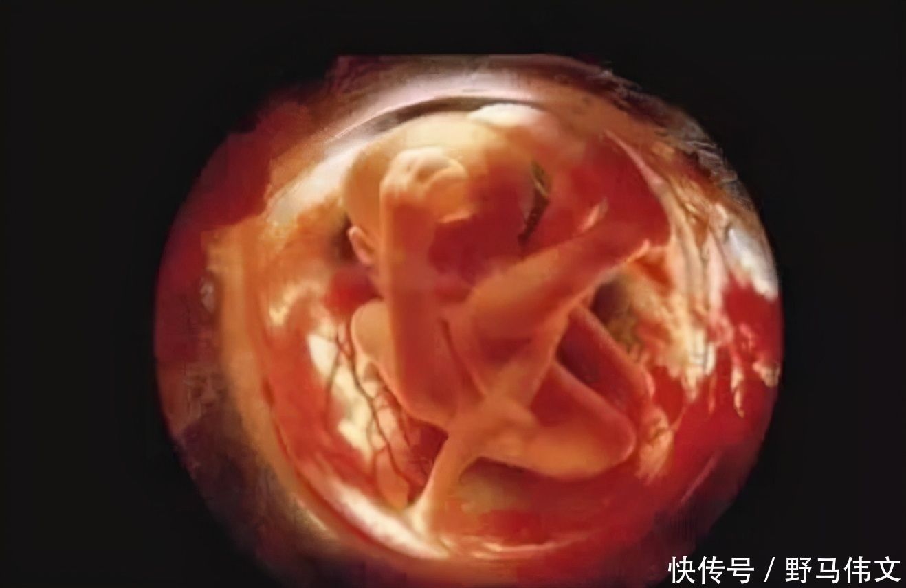 胎儿|孕期在孕妈肚子里的胎儿，排出的便便去哪了孕妈听了别“恶心”