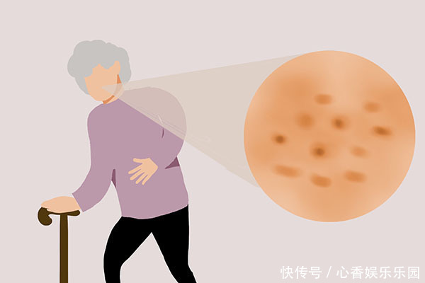 今年65岁了,脸上没有老年斑,她是如何做到的保养秘诀是什么