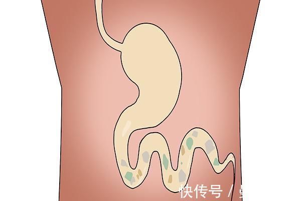 大便|排便时，大便“前硬后软”意味着什么？关于这几个原因，别忽视