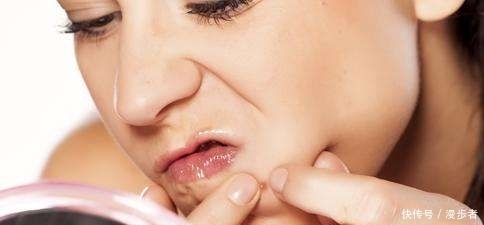 脸上螨虫滋生长痘?不妨用厨房里的这样两样东西,每天抹下全消失