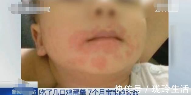 食物|一岁前,十种食物孩子还不能吃,家长千万别掉以轻心