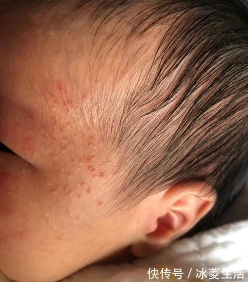 辅食|1岁内娃,2种辅食易消化、益脾胃,孩子吃好不积食,养出好体质