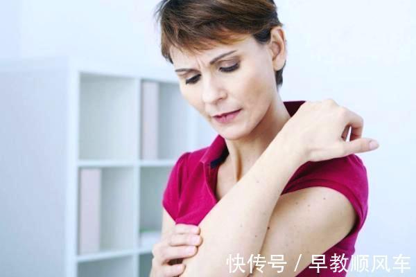 荨麻疹|夏季皮肤过敏反复发怎么办？反复发作要做的这三件事情要记住