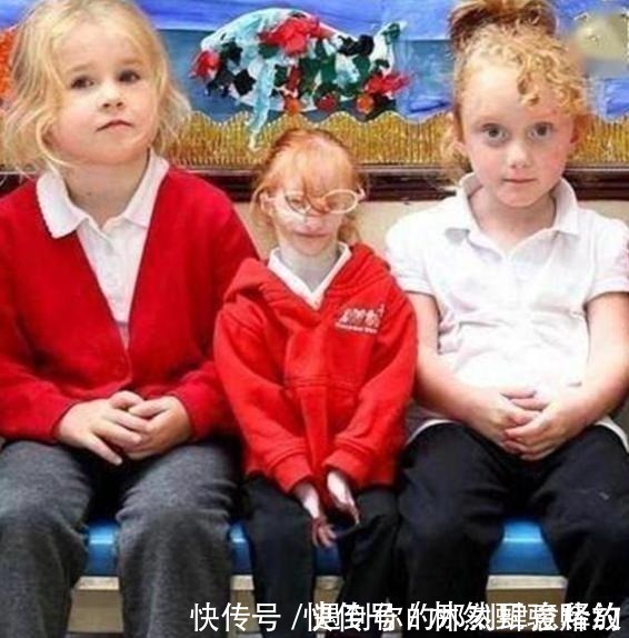 姑娘|14年前出生时不足1斤的“拇指姑娘”,现状如何网友惊人反转