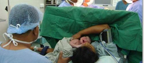 宫缩|生孩子前,先破水好,还是先见红好对宝宝来讲,一个区别蛮大的