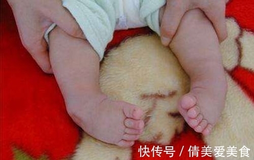 小儿脑瘫|脑瘫的晚期症状:小儿脑瘫患者,通常有什么表现?