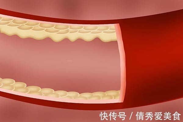 血管|晚餐喝一二两酒，养生还是伤身？医生说出实话，别再信谣言