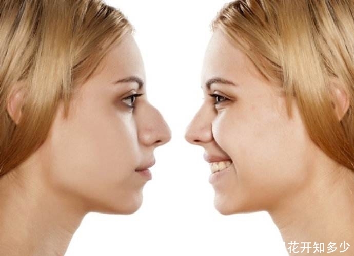 女子整鼻失败,调整三次都失败,工作人员:失败是成功之母