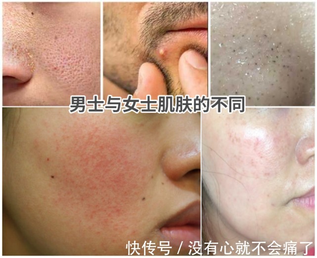 皮肤|男士能用女士护肤品吗?男士如何正确护肤?