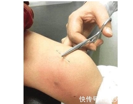 裤子|四岁女童举止怪异,妈妈拉裤子检查,连忙送往医院,医生都懵了