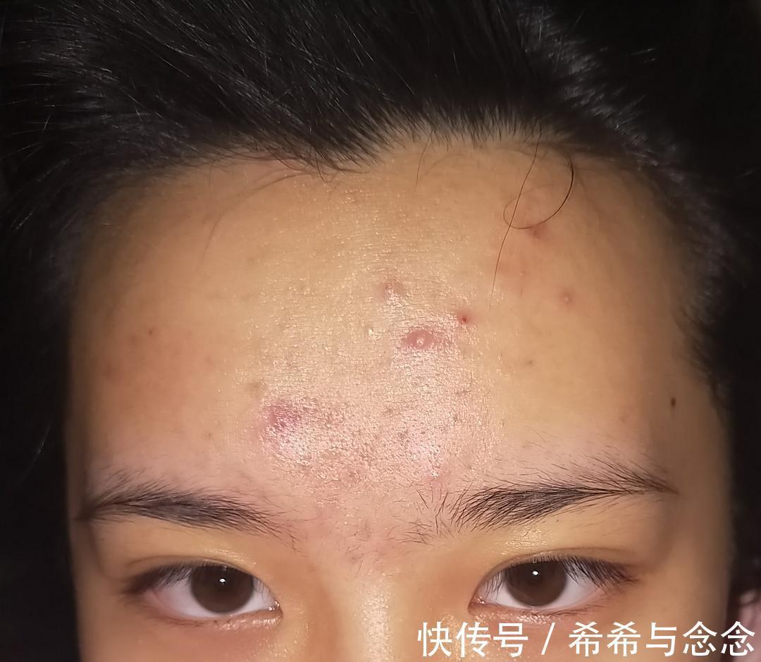 成分|2021爆火水乳护肤品红黑榜！粉水、神仙水均上黑榜，红榜孕妇可用