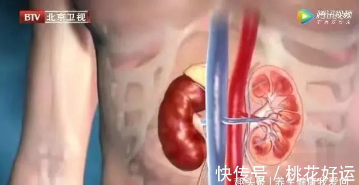 肝气不舒|凌晨1-3点容易醒?是身体2个地方堵了!老中医这样吃,安睡到天亮