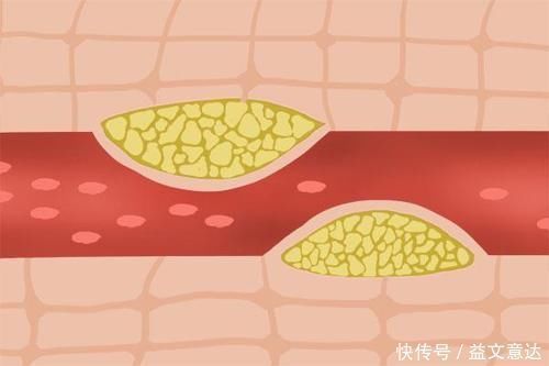 地筋|脚底有条养肝筋,每天揉一揉,疏肝气、排肝毒,补气强身易长寿