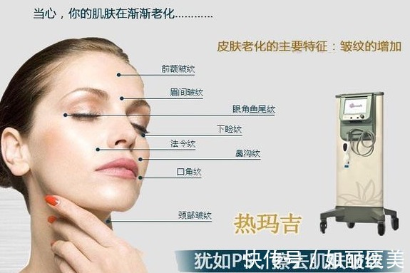 手术 抗衰新星热玛吉原理|热玛吉能维持多久?有没有危险呢?