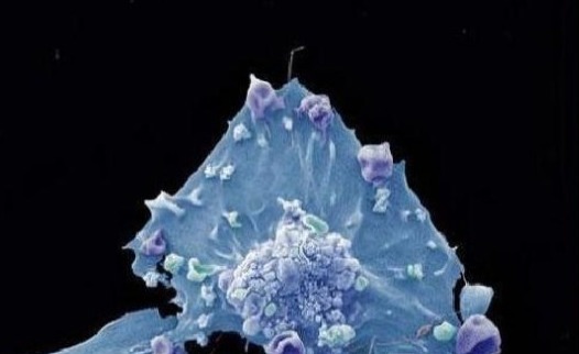 肿瘤|为什么有些人不易得癌肿瘤科主任他们可能有六个特点