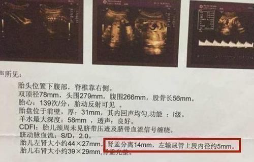 孕妈们|通过产检B超单的“肾盂分离”,可判断胎儿性别还真有一定道理