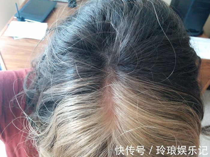 脚趾|19个“被上帝挑选过”的特殊基因人类,怎么梳都不整齐的头发