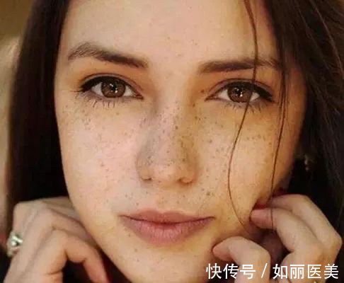 皮肤 祛斑功课丨激光祛斑反黑是怎么一回事?术后都有哪些注意事项?