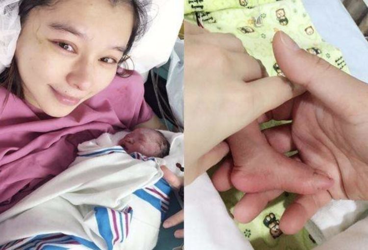 肚子|为何女明星宁愿在肚子“挨一刀”,也不愿顺产生娃?情有可原