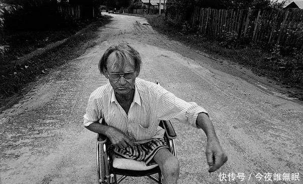 被核辐射影响的日本后果惨不忍睹 核能 中国经济新闻网www Jjxww Com