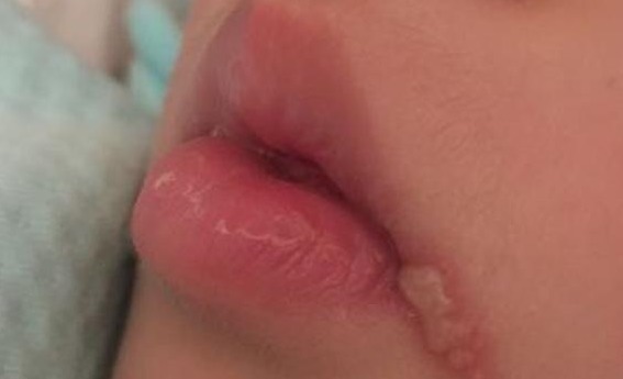 红霉素|红霉素睡前抹一抹,醒来皮肤“重回十八”,尤其女性要了解