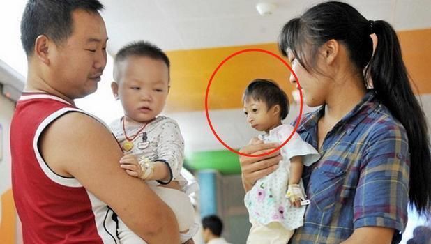 尼克|90后孕妇生下“海豹胎”,曾拒绝医生打掉,如今杂戏团要高价收购