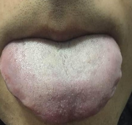 津不上承|老中医告诉你一到晚上就口干口渴的厉害是怎么回事