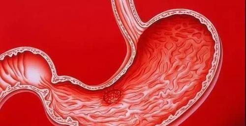  胃黏膜的“修复器”找到了，别不舍得吃， “老胃病”慢慢变好