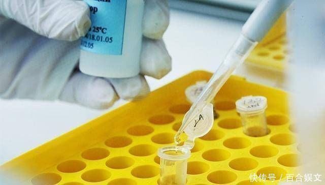 dn怀孕期间做三次检查，第一次很贵，第三次可能没用你可能想知道