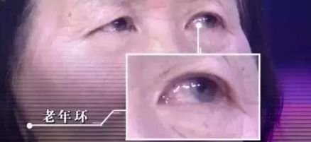 面相|注意!这几种面相可能预示着心脏疾病,很多人都忽视了…