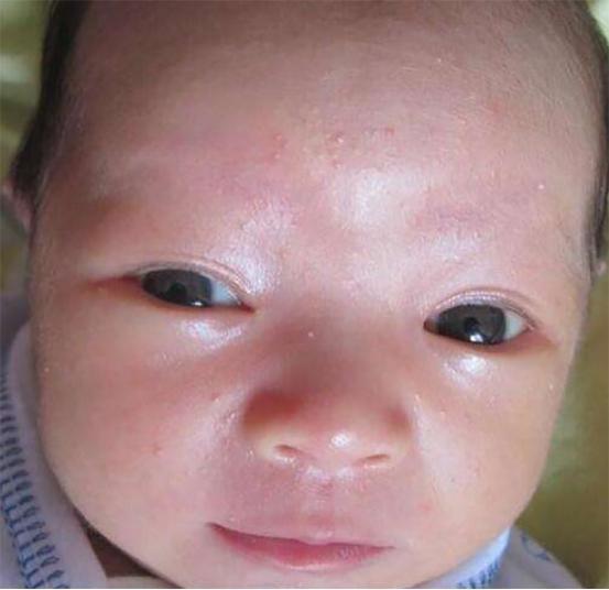 行为|儿科医生奉劝不想宝宝总被湿疹折腾,妈妈5个行为少对宝宝做