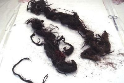 慈禧|光绪到底被谁毒杀的？专家：不是慈禧和袁世凯，她才是最大嫌疑人