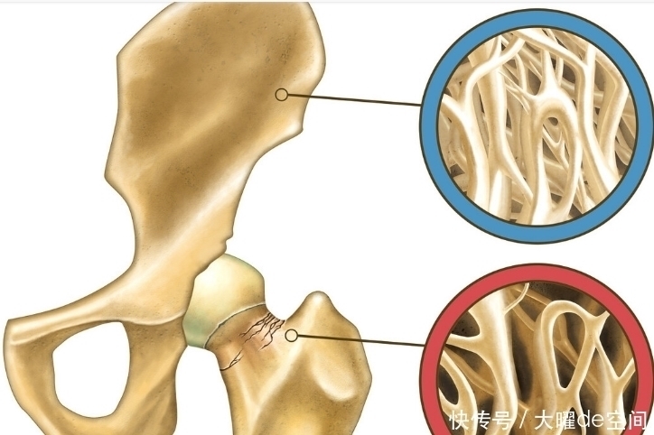 骨密度|要想预防骨质疏松,常吃4种食物,或可补充骨骼营养,增强体质