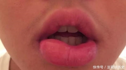 嘴唇|女生有这3习惯？难怪嘴唇“越来越厚”，再不改小心变成“猪圈嘴”！