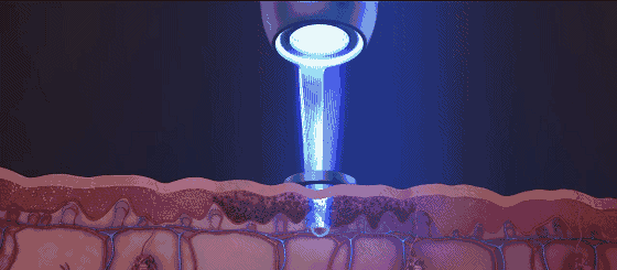 爱豆们竞当医美达人？男性适合的轻医美项目top5合集