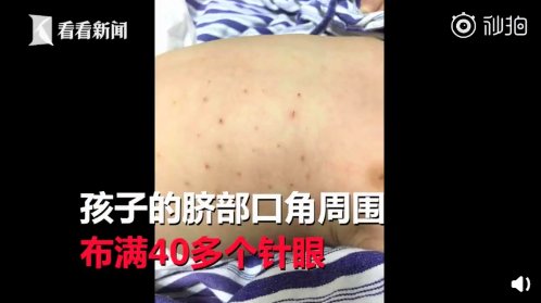 鸽子粪|吞蝌蚪、喝蟑螂水、吃鸽子粪……你被“偏方秘方”坑过吗?