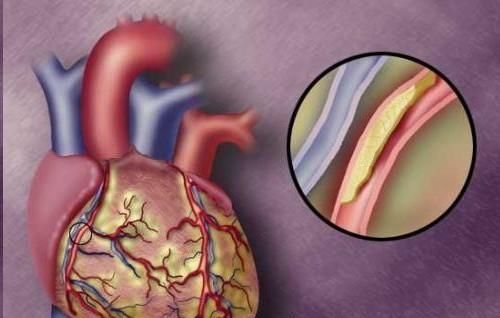 蒲公英|高血脂最爱3种肉，若能做到忌口，血脂自己往下降，人健康10倍