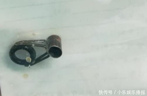 锁头|为救六岁女童医生小心翼翼，家长一定不要额外损伤