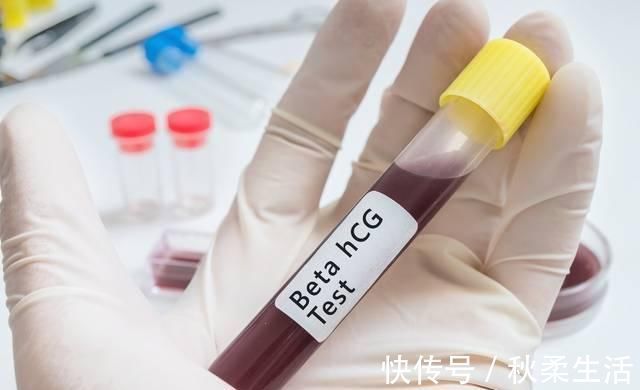 血管|脑梗发作只需21秒，医生有这3个习惯，血管不堵，脑梗不敢来