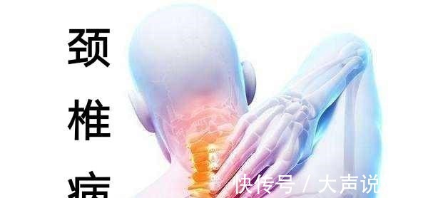 神经根|颈椎病严重时，什么部位会疼得厉害！
