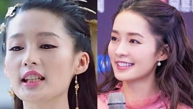 有一种整容叫拔牙，乔欣秒变小V脸，但她的改变才是最大的