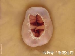 预产期|女子怀孕11个月还不发动,医生强行剖腹,孩子出生后全家泣不成声