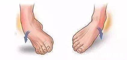 扭伤|左病右治,上病下治—尤其适合四肢部位疾病,可能用到,建议收藏