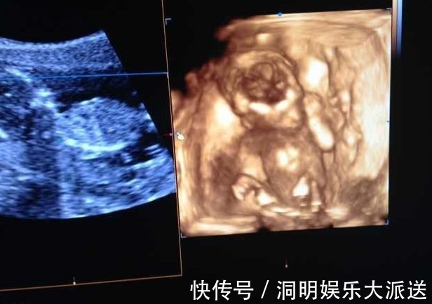 孕妇|婆婆陪孕妇去产检,医生将婆婆支开,问了一个问题,孕妈瞬间脸红