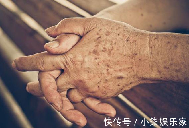 大蒜|老年斑太难看怎么办老奶奶教你3招,淡化20年斑,试过都说好