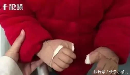 孩子们|3岁女童手指无法屈伸,元凶家家都有,这类“精神鸦片”害娃不浅